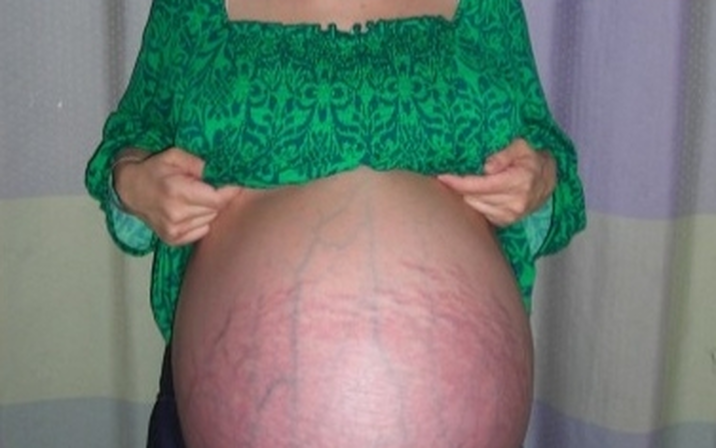 Avatar of Octomom