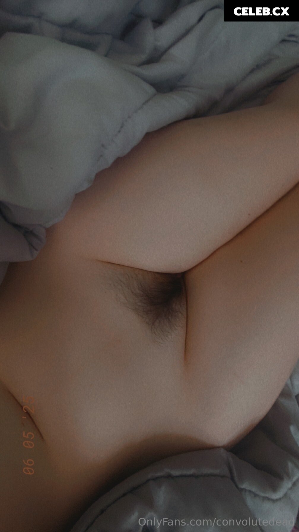 convolutedead Image 8845189