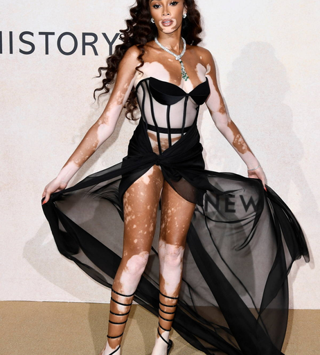 Image 9957292 from Winnie Harlow