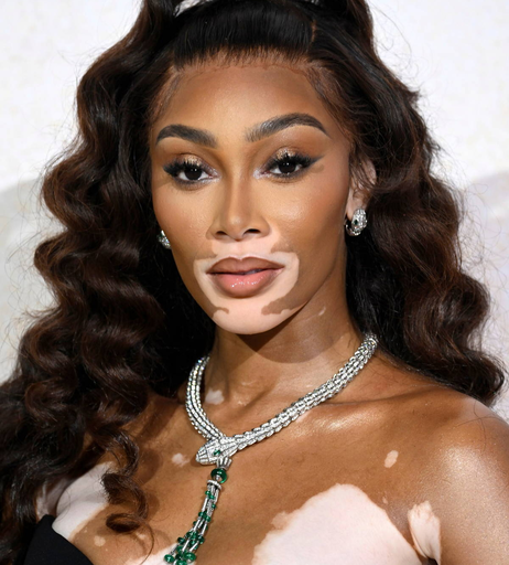 Image 9957283 from Winnie Harlow