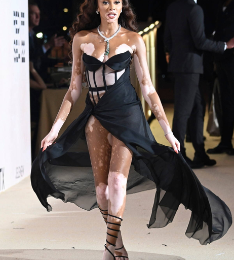 Image 9957286 from Winnie Harlow