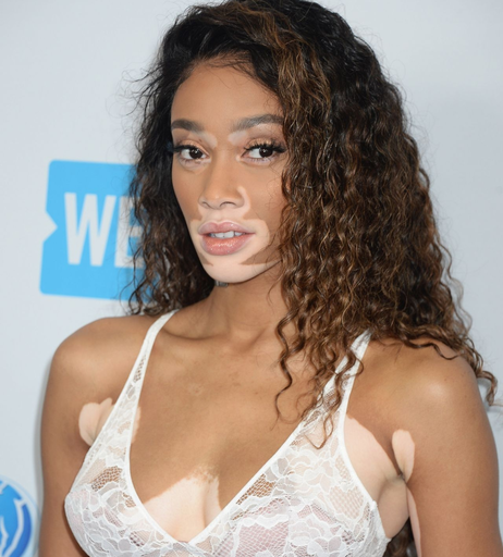 Image 9943742 from Winnie Harlow