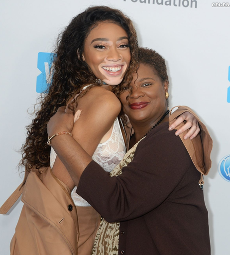 Image 9943733 from Winnie Harlow