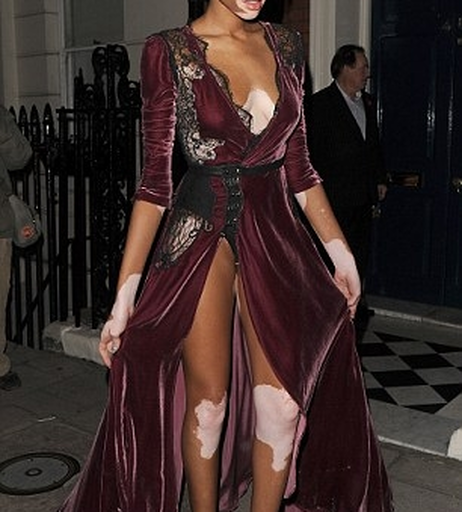 Image 9943734 from Winnie Harlow