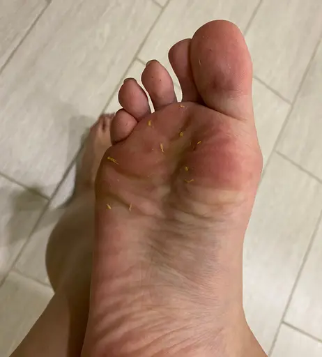 Image 9499099 from feeTLady