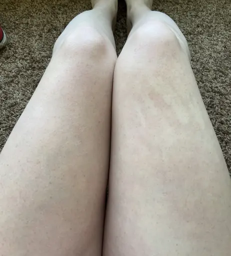Image 8548368 from Freckledspirit / Creepyspookygirl / Freakysweetgirl / creepyt0es