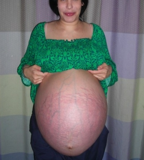 Image 2114713 from Octomom
