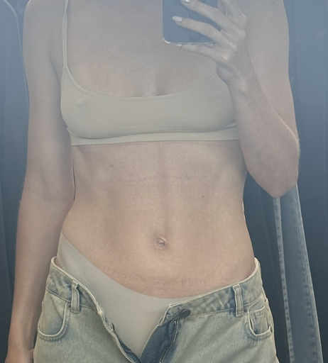 Image 2033996 from Lena Gercke