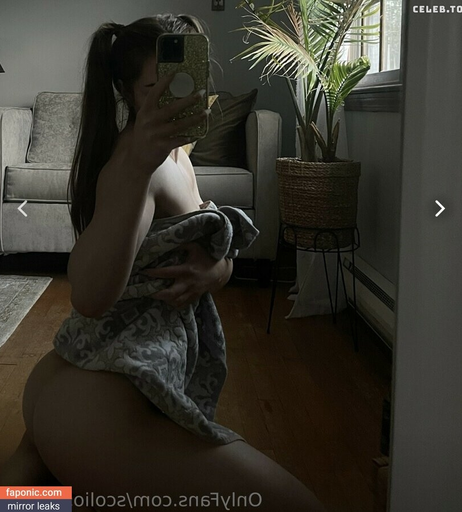 Image 202272 from Scoliosis.soph