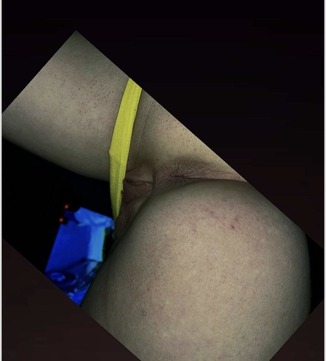Image 1697774 from Melinda Erfurth