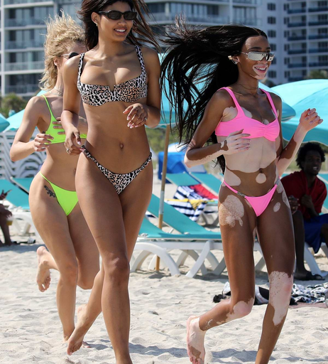 Image 1736665 from Winnie Harlow
