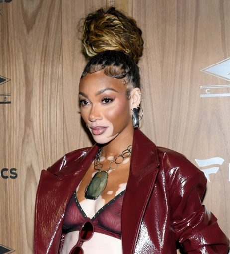 Image 1738682 from Winnie Harlow