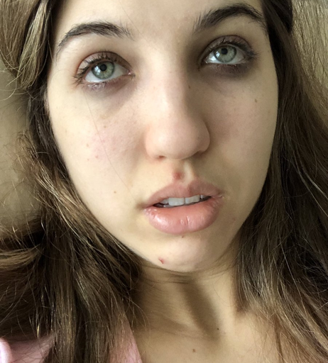 Image 1081851 from Frivolousfox ASMR