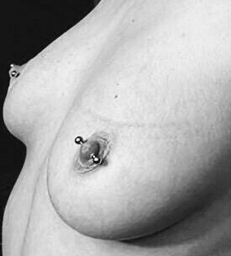 Image 393906 from Bettie Pain