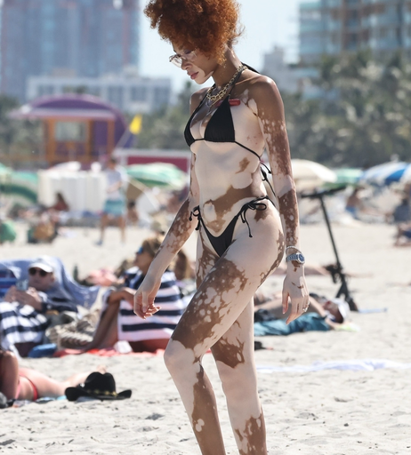 Image 6570126 from Winnie Harlow