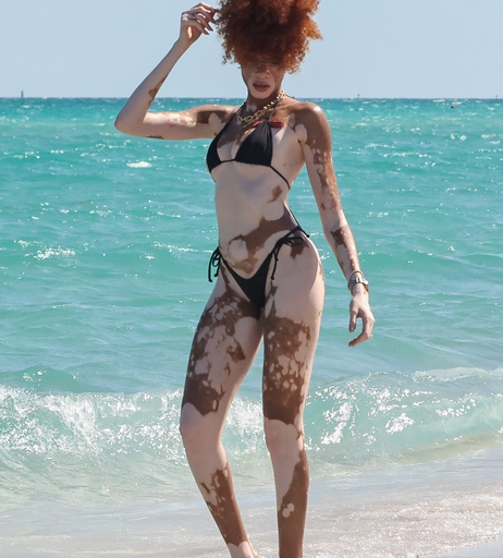 Image 6570324 from Winnie Harlow