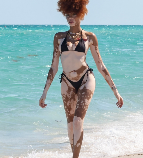 Image 6570285 from Winnie Harlow