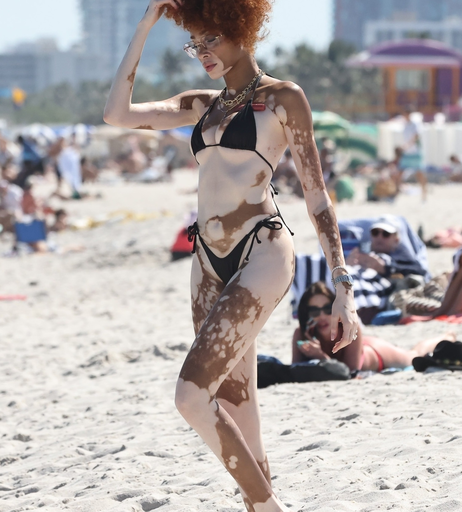 Image 6570244 from Winnie Harlow