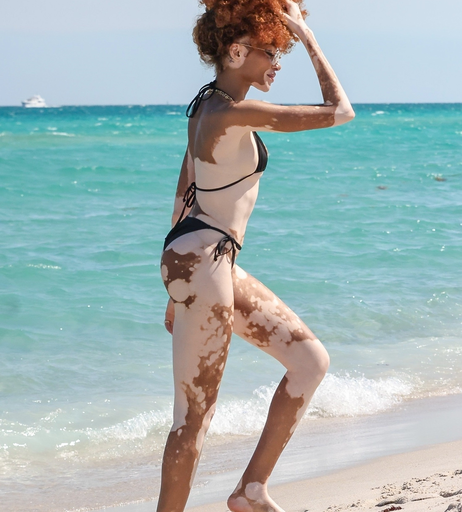 Image 6570264 from Winnie Harlow