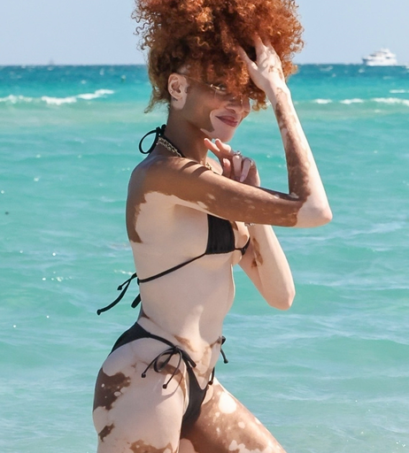 Image 6569816 from Winnie Harlow