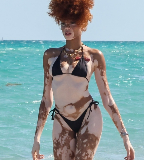 Image 6569785 from Winnie Harlow