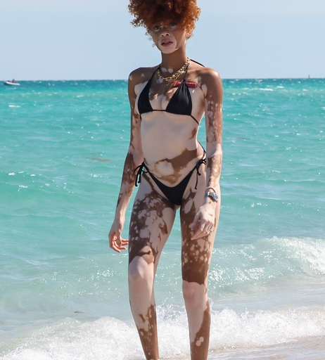 Image 6569995 from Winnie Harlow
