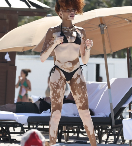Image 6569915 from Winnie Harlow