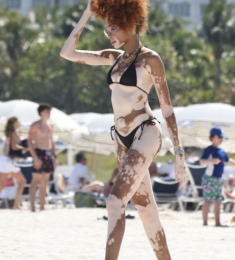 Image 6569927 from Winnie Harlow
