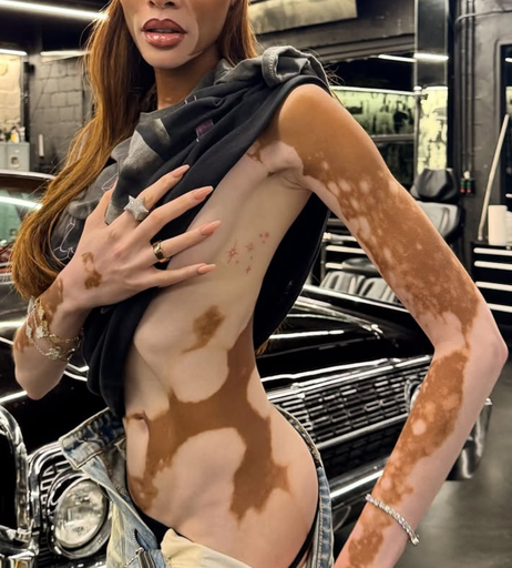 Image 5618894 from Winnie Harlow