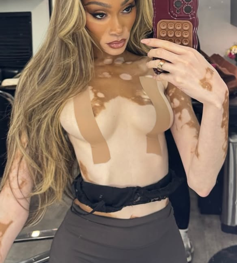 Image 5618900 from Winnie Harlow