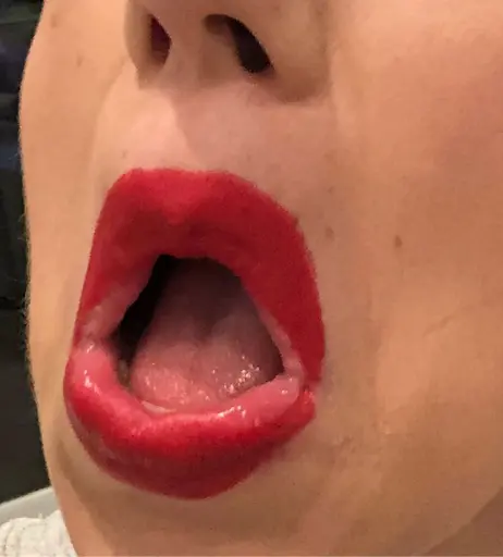 Image 4828520 from Colleen Ballinger (Miranda Sings)