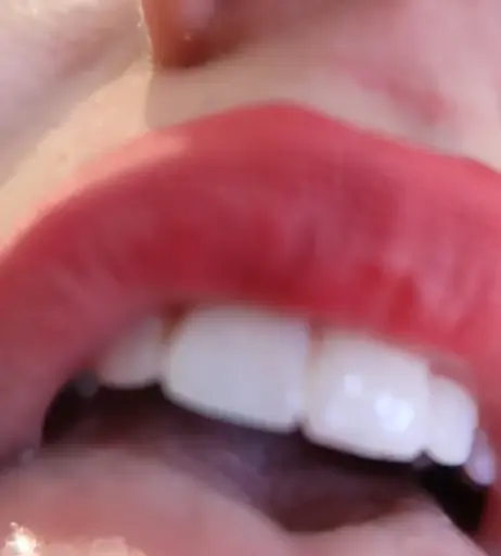 Image 4828613 from Colleen Ballinger (Miranda Sings)