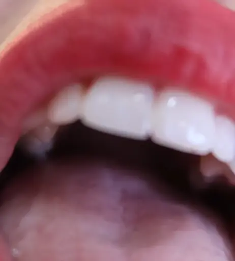 Image 4828628 from Colleen Ballinger (Miranda Sings)