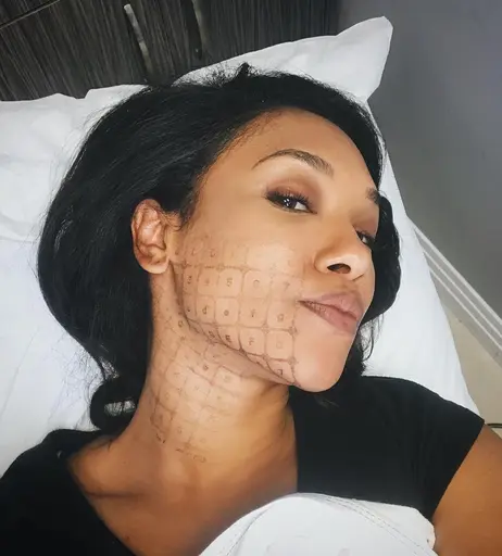 Image 7168690 from Candice patton