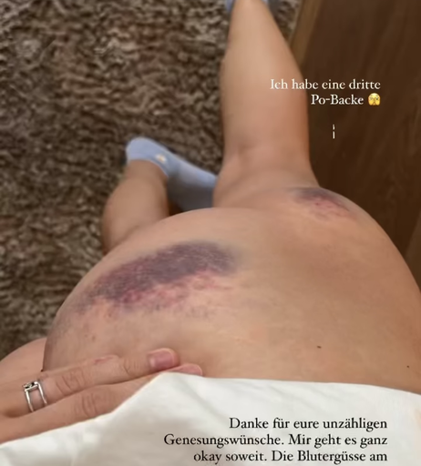 Image 725375 from Carmushka