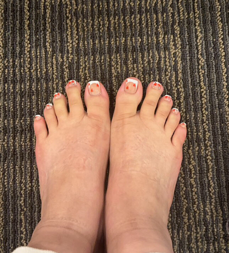 Image 7452275 from Yomfeet