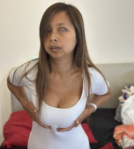 Image 7445558 from BlindAsia2024