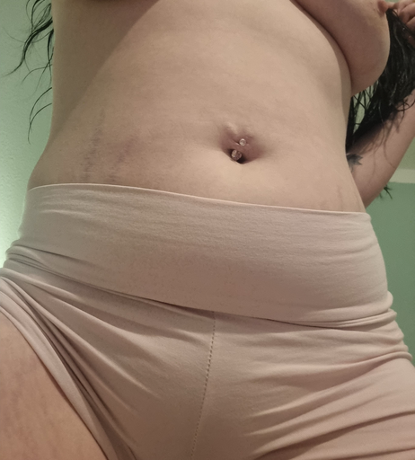 Image 7652131 from Hxrnyunicxrn